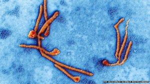 Este es ebola; como se vera el virus del miedo bajo el microscopio?